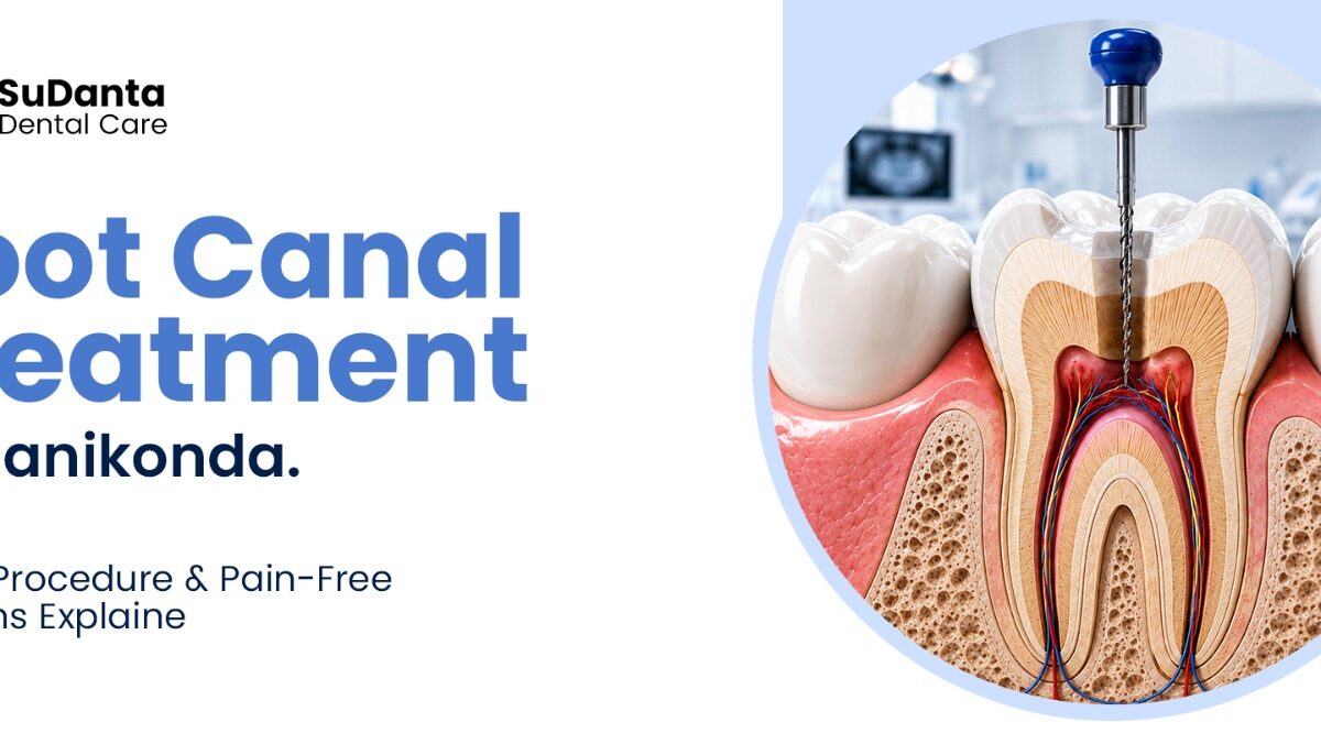 Root Canal Treatment in Manikonda