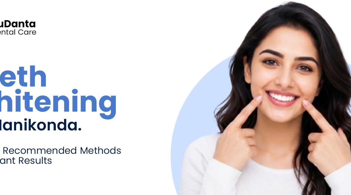 Teeth Whitening in Manikonda