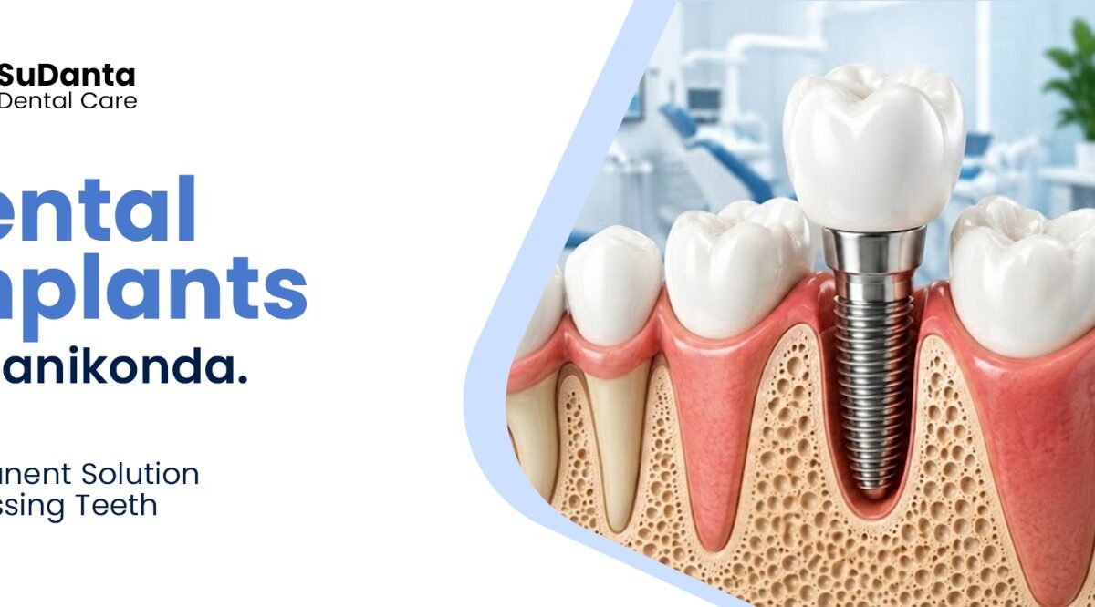 dental implants in Manikonda