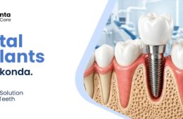 Dental Implants in Manikonda: The Permanent Solution for Missing Teeth (2026 Guide)