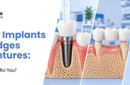 Dental Implants vs Bridges vs Dentures: Which Is Right for You?