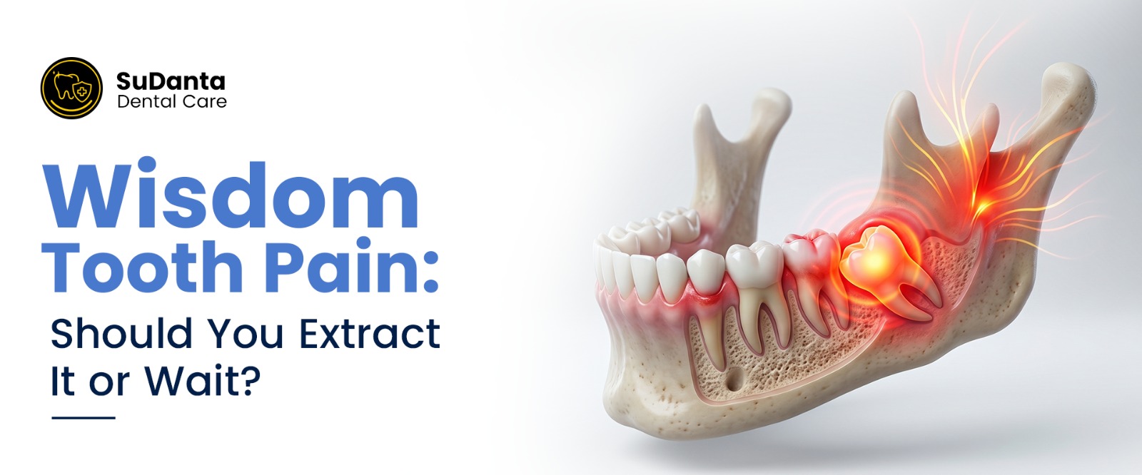 wisdom tooth pain extract or wait