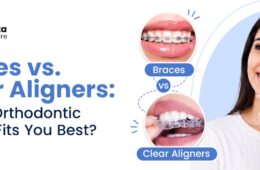 Braces vs. Clear Aligners: Which Orthodontic Option Fits You Best?