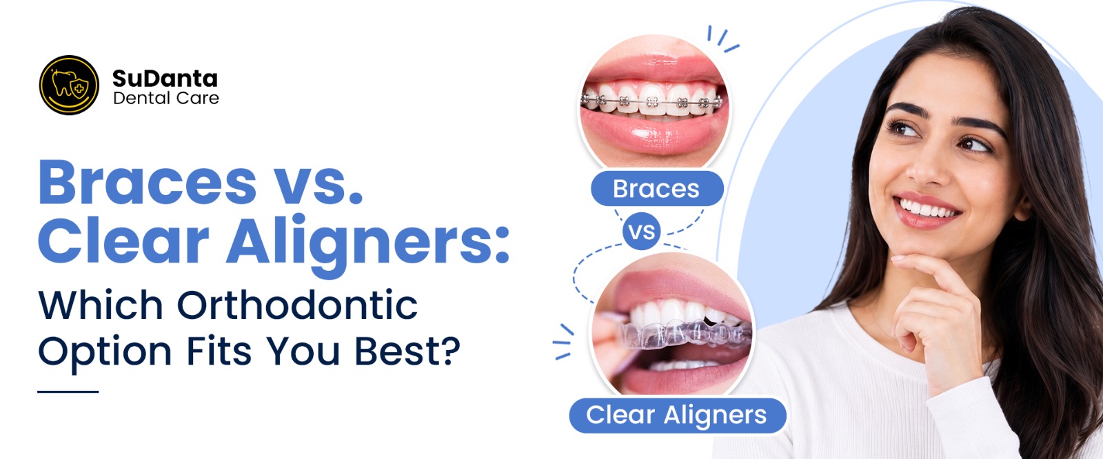 braces vs clear aligners